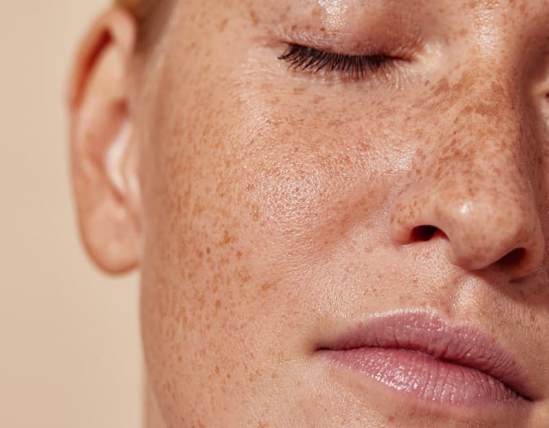 Consigue una imagen renovada